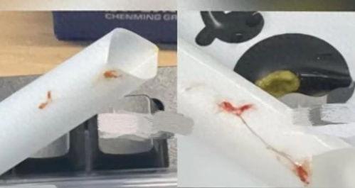 饮痰在线视频,揭秘痰液的秘密与健康管理之道 第2张 饮痰在线视频,揭秘痰液的秘密与健康管理之道 第2张