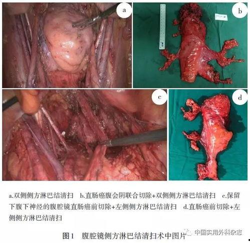 月经后入 在线视频,揭秘生理与心理的双重奥秘